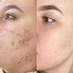 Skinify’s Skin Repair & Brightening Serum Duo