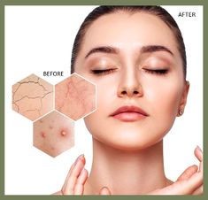 Skinify’s Brightening Serum & Gentle Exfoliating Cleanser Duo